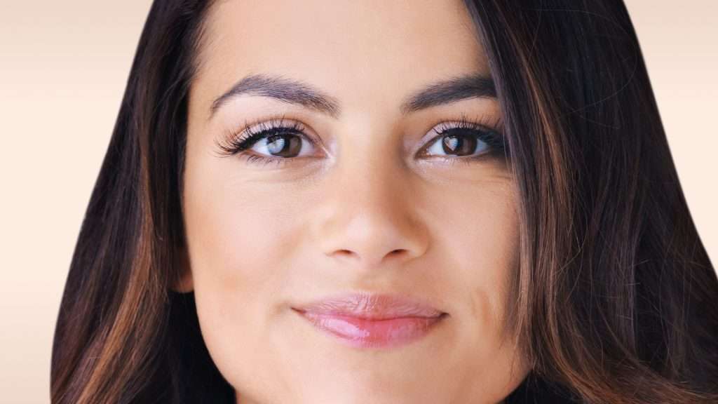 Bild eines Modells profhilo Behandlung glowtox