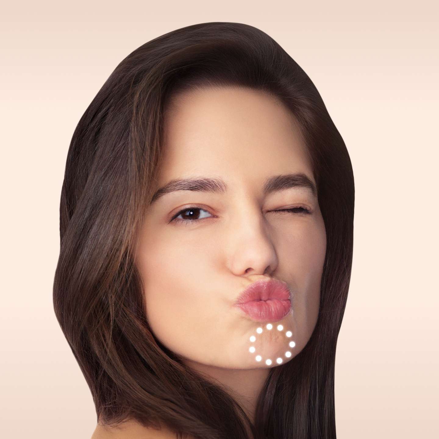 Bild eines Modells Erdbeerkinn Behandlung glowtox