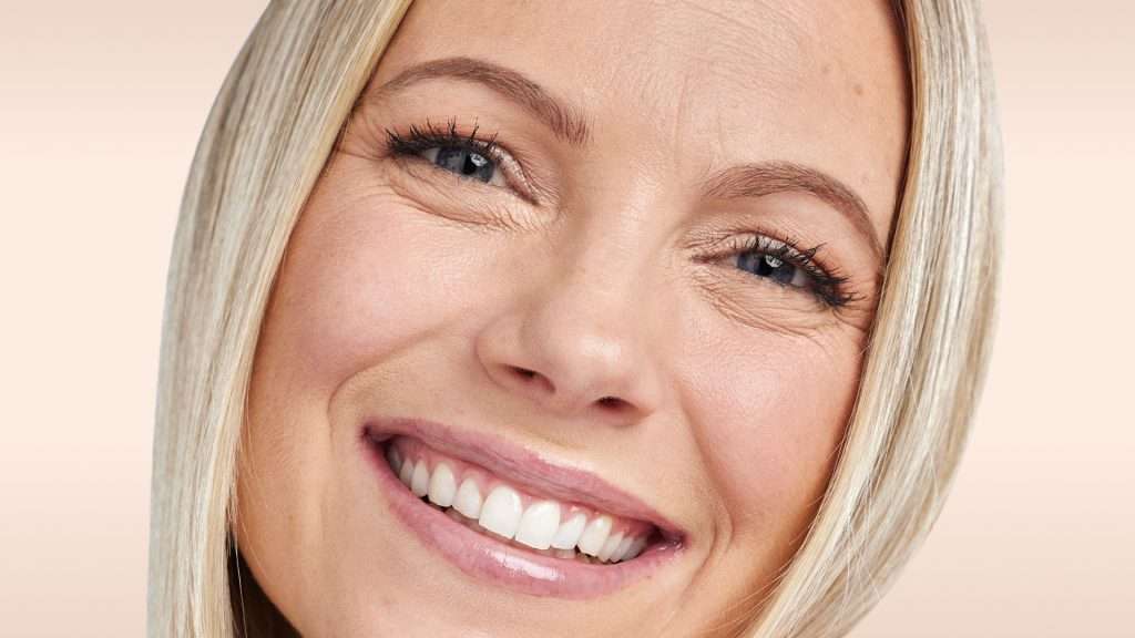 Bild eines Modells Zornesfalte Behandlung glowtox